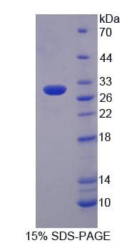 Mouse PTPRN2 / Phogrin Protein (Recombinant)