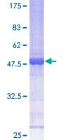 Human CRIP2 Protein (Recombinant GST)