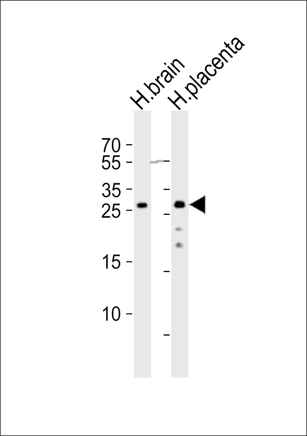 CHMP4A Antibody (aa205-239)