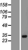 Human SMN2 Protein (Over-Expression Lysate Myc-DDK (Flag))