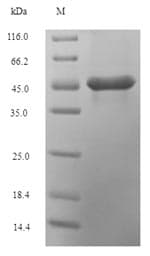 Maize SH-1 Protein (Recombinant 6His-SUMO, N-terminus)