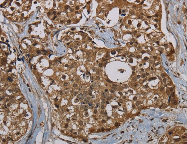 PNN / Pinin Antibody