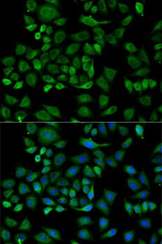 HP / Haptoglobin Antibody