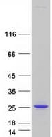 Human CGGBP1 Protein (Recombinant Myc-DDK (Flag))