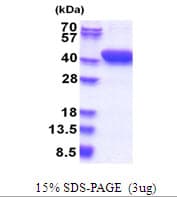 Human MESDC1 Protein (Recombinant His)
