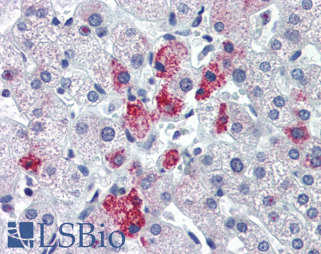 Polyclonal Rabbit anti-Human HMGN1 / HMG14 Antibody (aa36-85, IHC, WB)