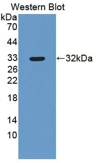 OASL Antibody (aa2-244)