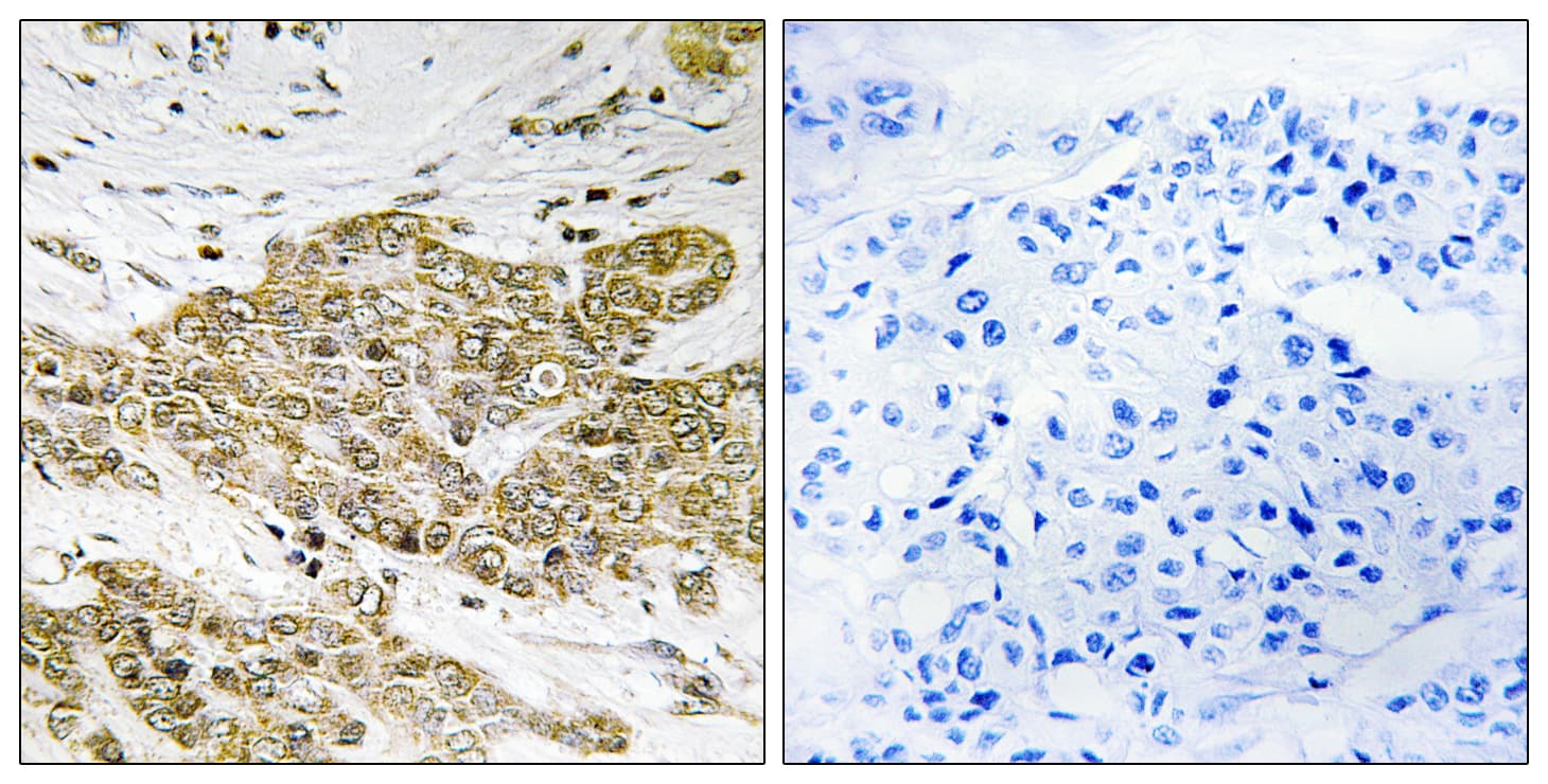 TP53 / p53 Antibody (phospho-Ser6)