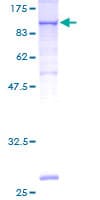 Human VCAM1 / CD106 Protein (Recombinant GST)