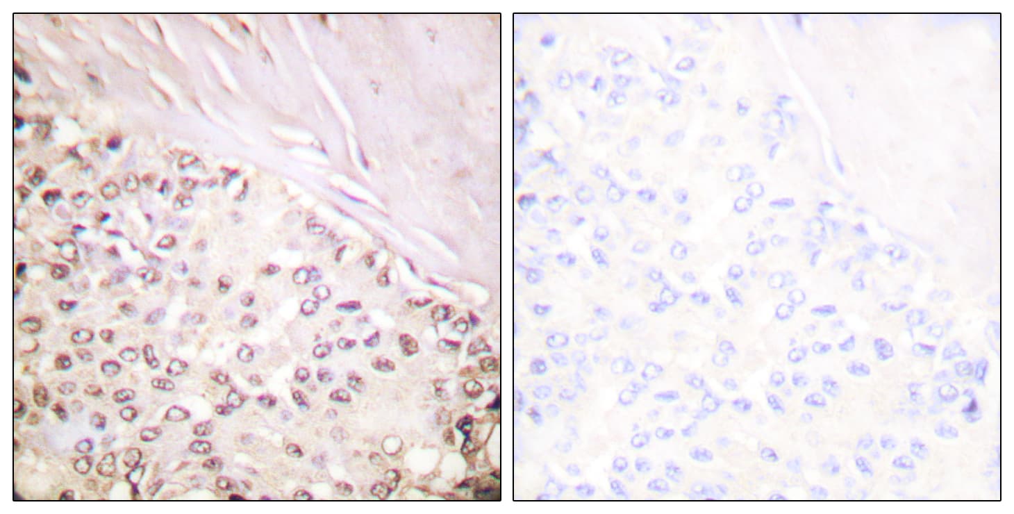 FANCD2 Antibody (aa188-237)