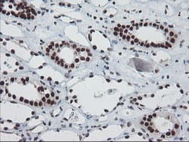 TPRKB Antibody (clone OTI3H3)