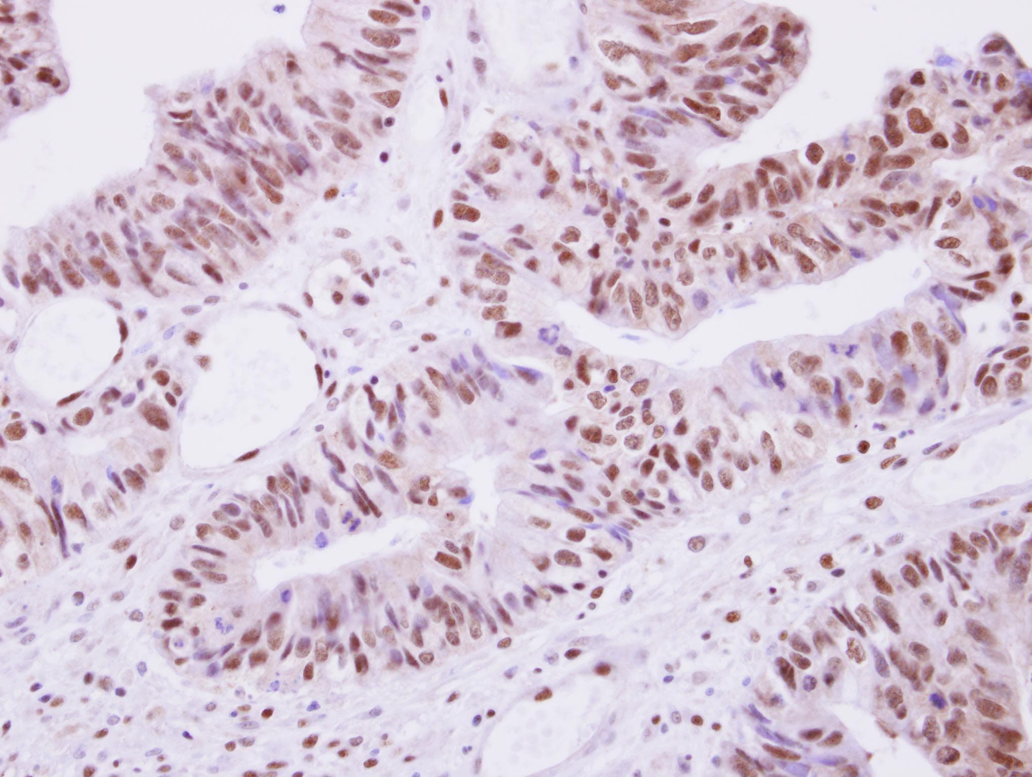 Polyclonal Rabbit anti-Human SEPHS1 / SPS Antibody (aa1-204, IHC, WB)