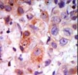 ADRBK1 / GRK2 Antibody (aa633-660)