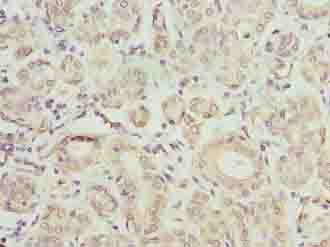 Polyclonal Rabbit anti-Human TMCC1 Antibody (IHC, WB)