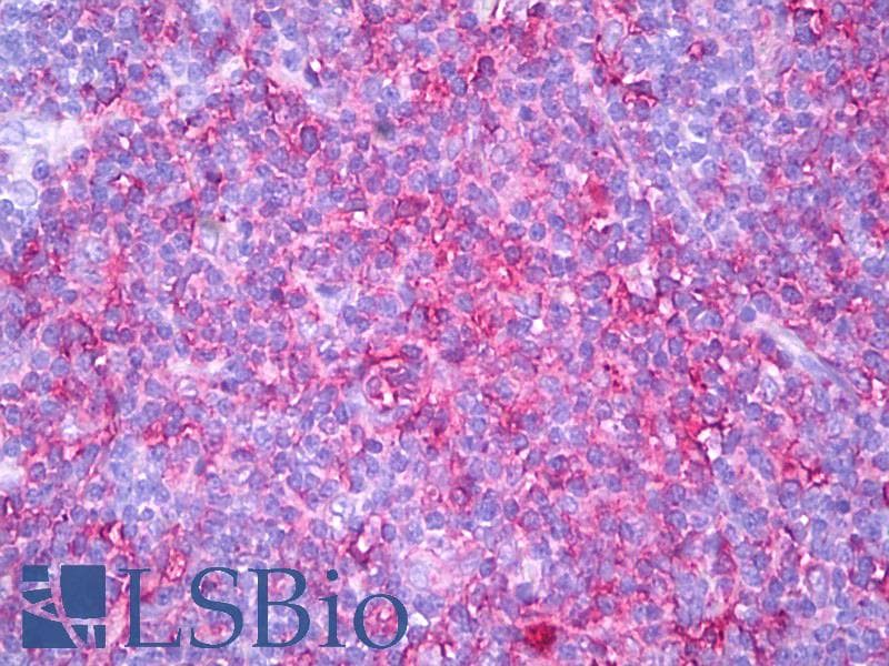 IHC-plus™ HLA-DR Antibody (clone YE2/36-HLK)