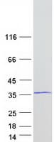 Human SLIM / FHL1 Protein (Recombinant Myc-DDK (Flag))