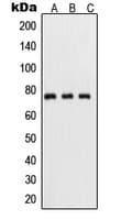 RELA / NFKB p65 Antibody (phospho-Ser311)