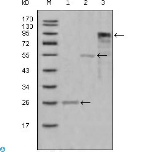MPO / Myeloperoxidase Antibody