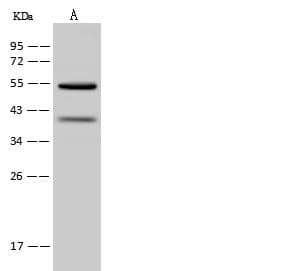 OXCT1 Antibody