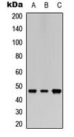 SSB / La Antibody (C-Terminus)