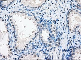 SORD / Sorbitol Dehydrogenase Antibody (clone OTI12A7)