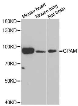 Polyclonal Rabbit anti-Human GPAM Antibody (IHC, WB)