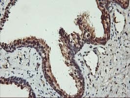 AKT1 Antibody (clone OTI4D6)