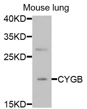 Polyclonal Rabbit anti-Human CYGB / Cytoglobin Antibody (IF, WB)
