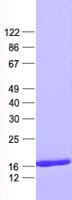 Human RPS16 / Ribosomal Protein S16 (Recombinant His, N-Terminal)