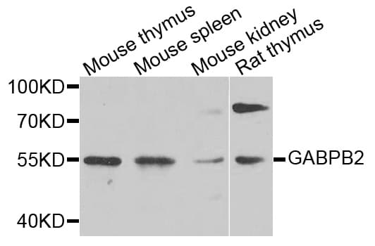 Polyclonal Rabbit anti-Human GABPB2 Antibody (WB)