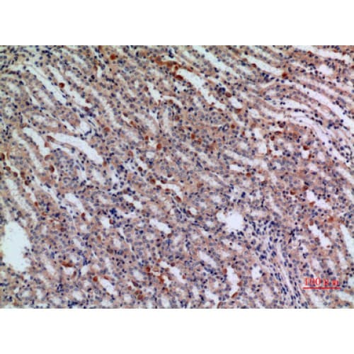 JAG1 / Jagged 1 Antibody (981-1030 aa, Internal)
