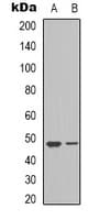 VEGFC Antibody (Internal)