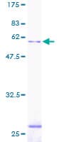 Human SGTA / SGT Protein (Recombinant GST)