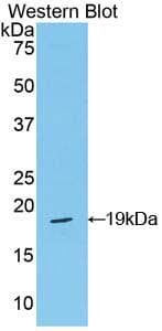 POSTN / Periostin Antibody (aa659-810)