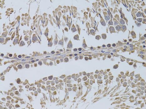 P2RY2 / P2Y2 Antibody