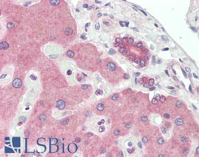 IHC-plus™ ABCB4 / MDR3 Antibody