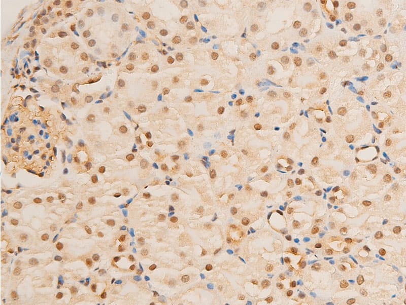 Polyclonal Rabbit anti-Human FOXO3 / FOXO3A Antibody (phospho-Ser253, IHC, WB)