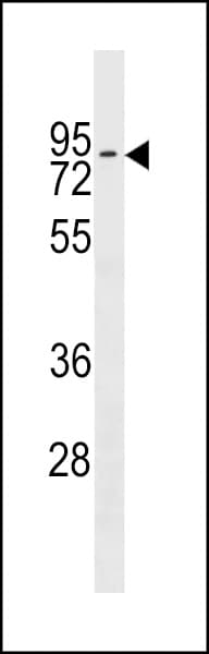 Polyclonal Rabbit anti-Human ZNF551 Antibody (aa208-235, WB)