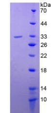 Human ITGA1/CD49a/Integrin Alpha 1 Protein (Recombinant His-S)