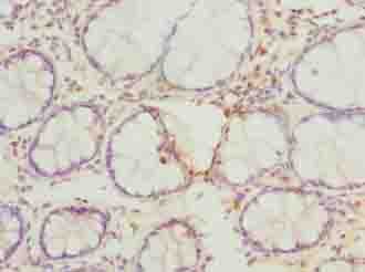 Polyclonal Rabbit anti-Human FAM82B Antibody (IHC, WB)