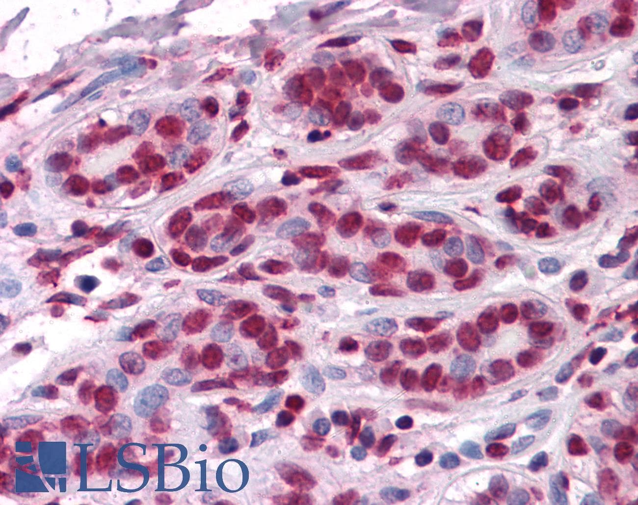 IHC-plus™ Monoclonal Mouse anti-Human ZBTB7B / HcKrox Antibody (clone 7C12, IHC, IF, WB)