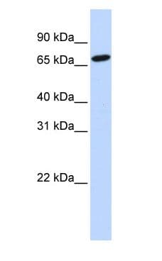 HAL / Histidine Ammonium Lyase Antibody (aa180-229)