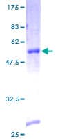 Human STMN4 / RB3 Protein (Recombinant GST)