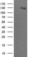 ERBB2 / HER2 Antibody (aa676-1255, clone OTI2A1, Carrier-free)