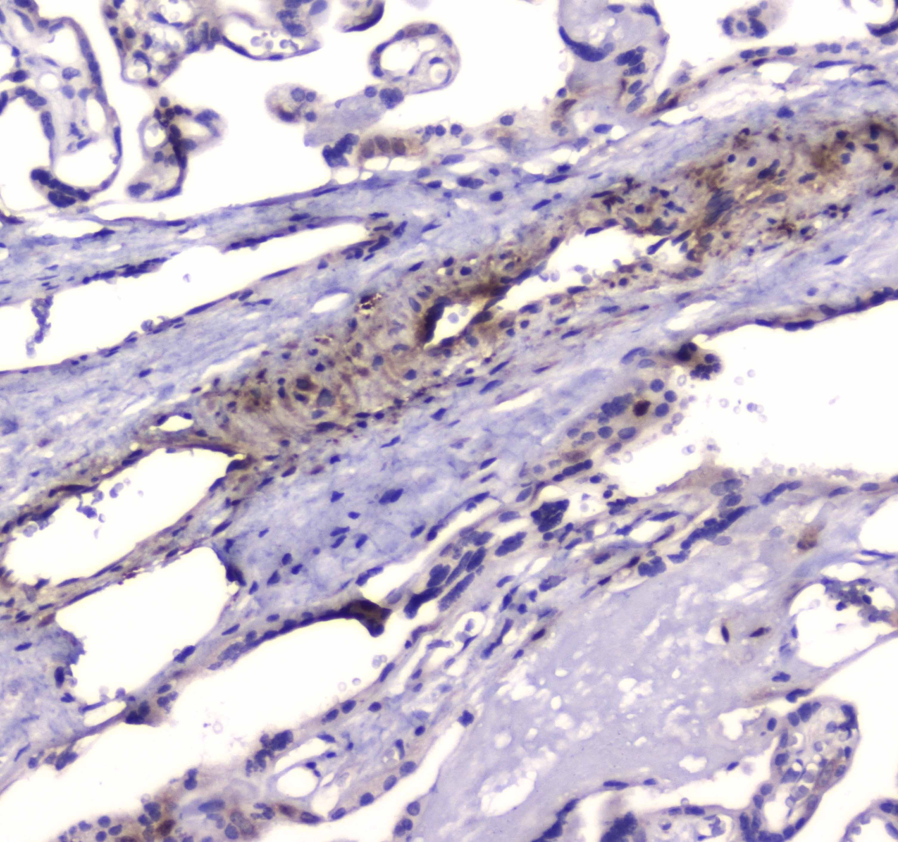 PDE4D Antibody