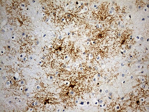 GPR17 Antibody (C-Terminus, clone OTI10B8)