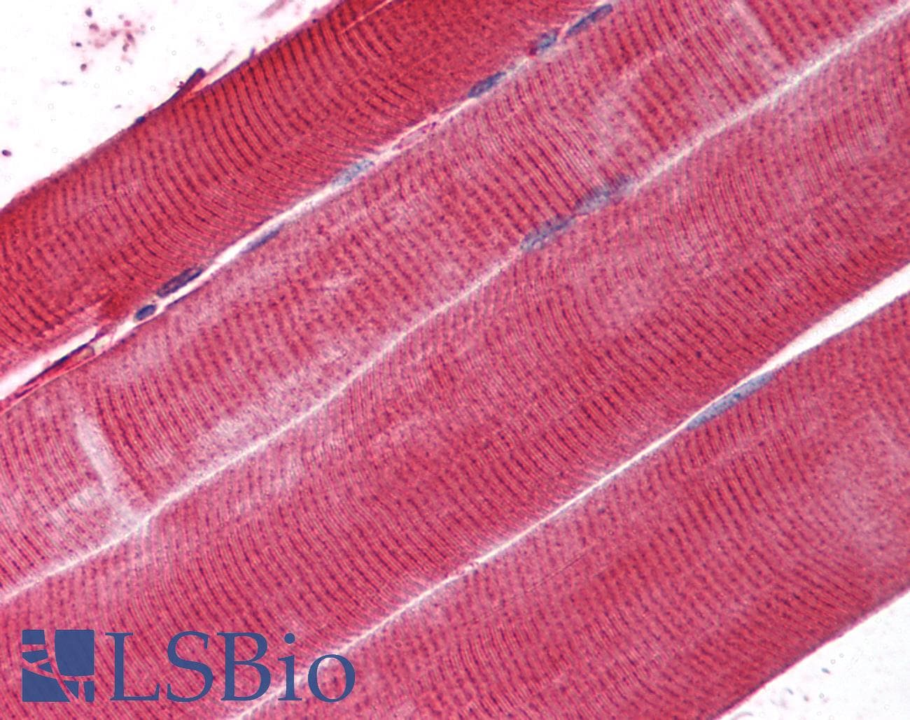 IHC-plus™ Polyclonal Rabbit anti-Hamster PLA2G6 / IPLA2 Antibody (aa557-576, IHC, WB)