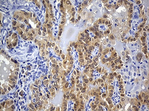 PRDX5 / Peroxiredoxin 5 Antibody (clone OTI3A1, Carrier-free)
