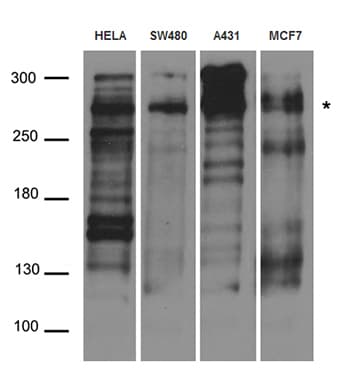 Polyclonal Rabbit anti-Human DSP / Desmoplakin Antibody (WB)