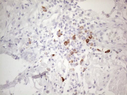 Monoclonal Mouse anti-Human TTC14 Antibody (clone OTI9E11, aa429-770, IHC, WB)